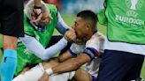 France confirm Kylian Mbappe injury plan after horror broken nose