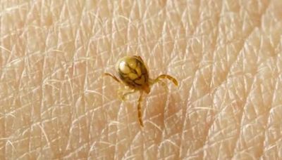 Doctors warn public about risks of tickborne illnesses as weather gets warmer
