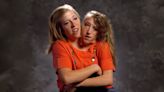 Everything to know about the conjoined twins Abby and Brittany Hensel