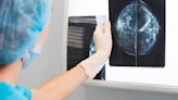 Task force updates guidance for breast cancer screenings