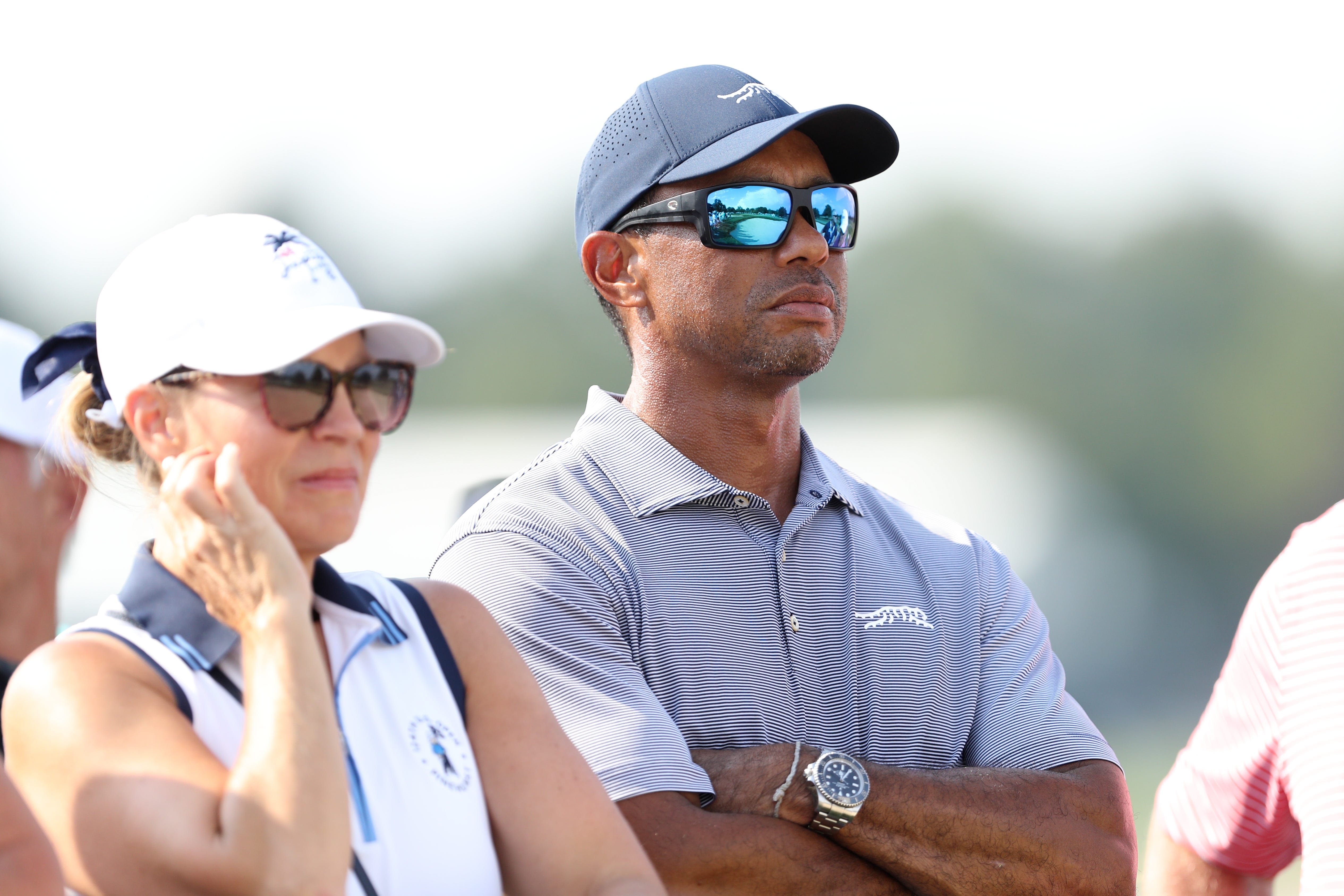 Tiger Woods' leg scar was visible at the U.S. Junior Amateur tournament