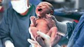 C-Section Delivery Linked to Decreased Vaccine Response in Babies, Study Finds