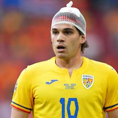 Fans compare Romania star to an onion as he is forced to wear hair net