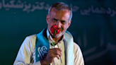 A Heart Surgeon Is Now Iran's New President, Masoud Pezeshkian Wins Presidential Polls