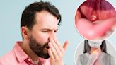 Here’s why your bad breath won’t go away — even after brushing