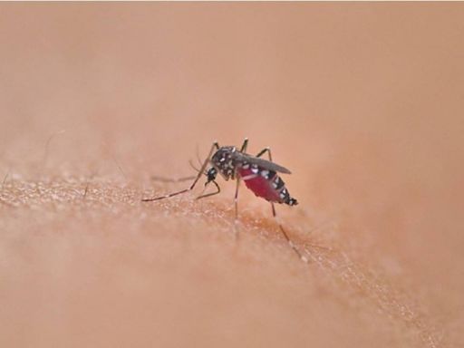 海島國家訂婚被蚊子叮咬！37歲女「染神祕疾病」慘禿頭、皮膚大面積脫落