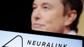 Elon Musk's Neuralink Brain Chip Implant "More Or Less Stable" In 1st Patient