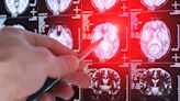 Children's brain cancer research gets £5m boost to cut treatment side effects