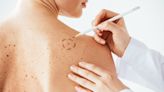 Wellness Wednesday: Skin Cancer Awareness Month
