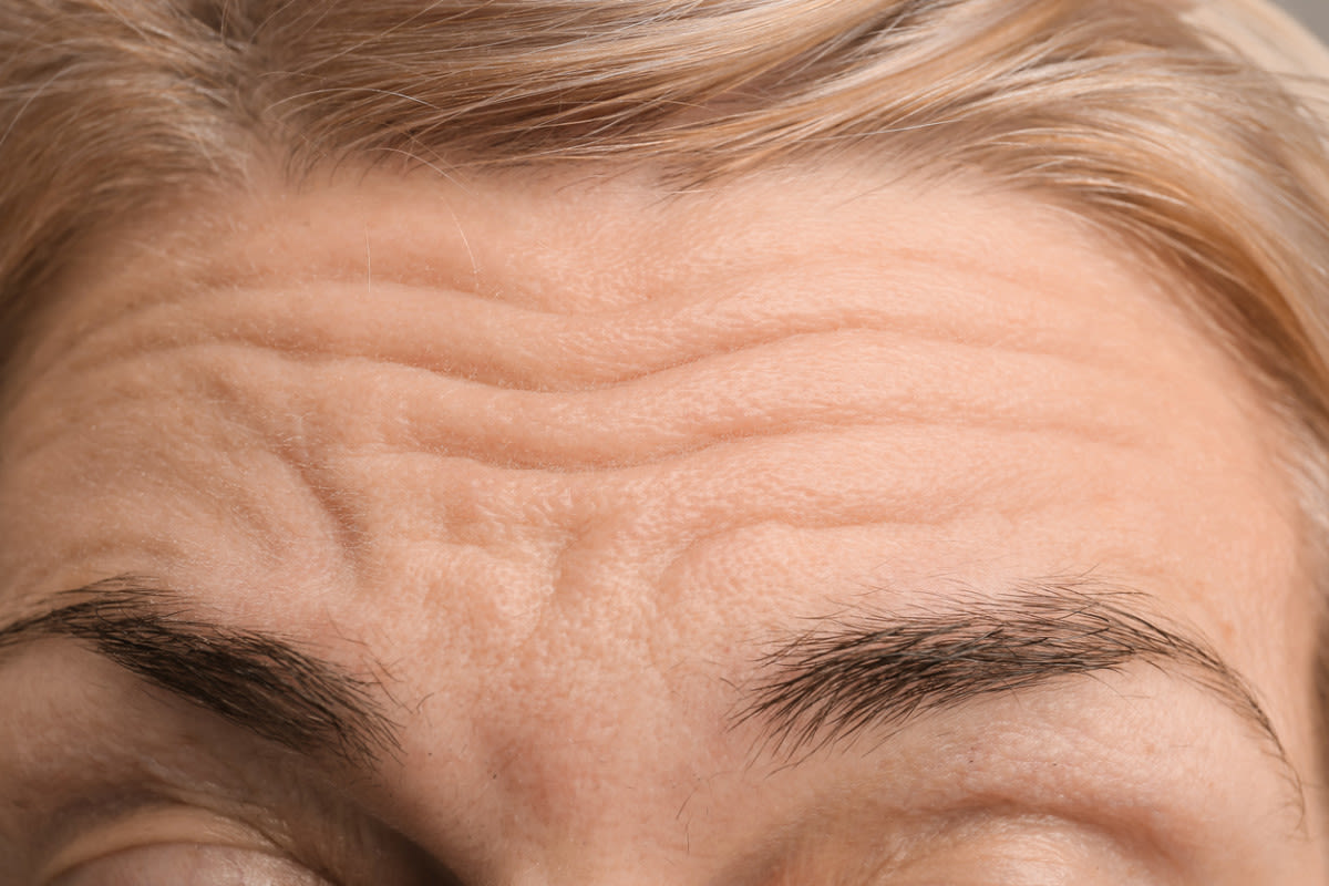 How To Get Rid of Forehead Wrinkles Over 50, According to Dermatologists