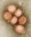 Swine influenza