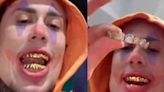 MC Daniel coloca prótese de ouro nos dentes; saiba o valor