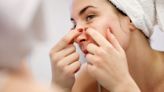 Here’s Why You Should Never Pop A Pimple On Your Nose