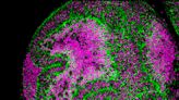 Study finds two genes of the germline are essential for the development of brain tumors in Drosophila