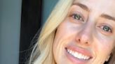Brittany Mahomes begs Instagram followers for help following skin flare-up