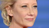 Anne Heche remains in critical condition, fashion designer Issey Miyake dies, and more trending news