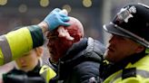 West Brom v Wolves: Six arrested after disruption at FA Cup match