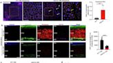 Researchers discover potential therapeutic target for degenerative eye disease