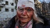 Blinded Ukrainian teacher warns war 'getting more dangerous every day'
