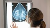 Few women are aware that breast density is an increased risk factor for cancer, new study shows