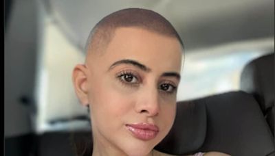 Urfi Javed Goes BALD? Actress Shares Bold Pic With No Hair, Shocked Fans Spot The Truth - News18