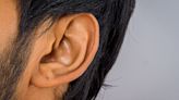 Researchers bioengineer skin, bioprint cartilage to fix ear malformation