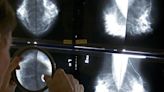 Task force: Mammograms should start at 40