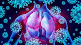 Long COVID-19 and other chronic respiratory conditions after viral infections may stem from an overactive immune response in the lungs