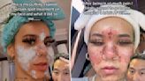 Doctor issues dire warning over using expired skincare products
