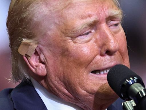 Donald Trump Ditches His White Ear Bandage for a Less Flashy Update