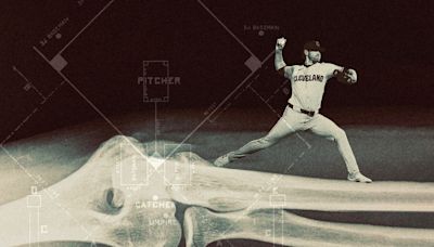 Major League Baseball is facing an epidemic of pitcher's injuries