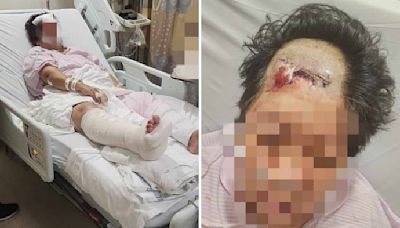 Daughter appeals for witnesses after mum ends up in A&E with no memory of hit-and-run accident
