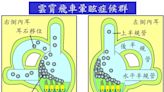 ＜耳鳴暈眩保健專欄＞搭雲霄飛車後 連暈多日