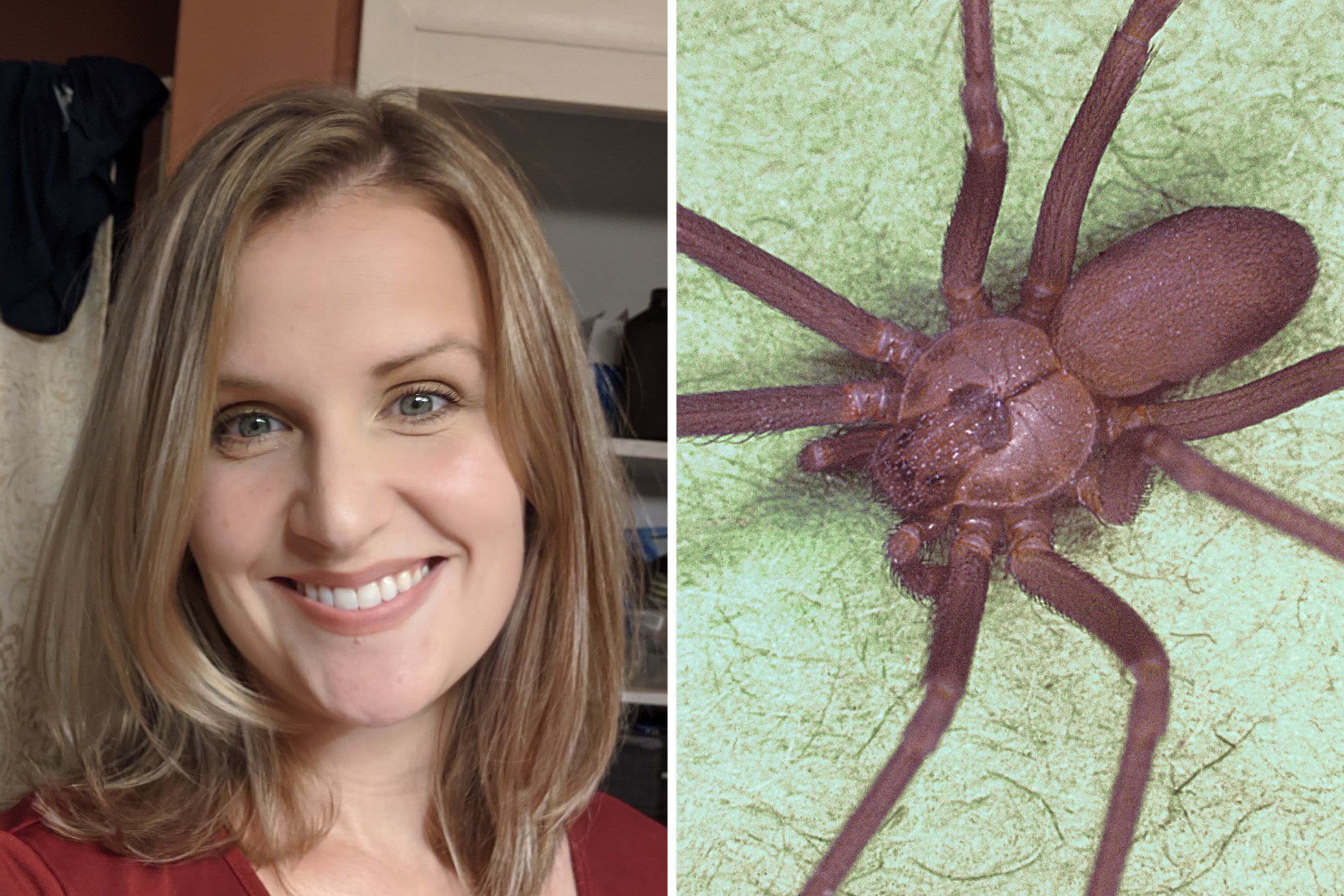 Brown recluse spider bite victims speak out: 'Pain like I've never felt'