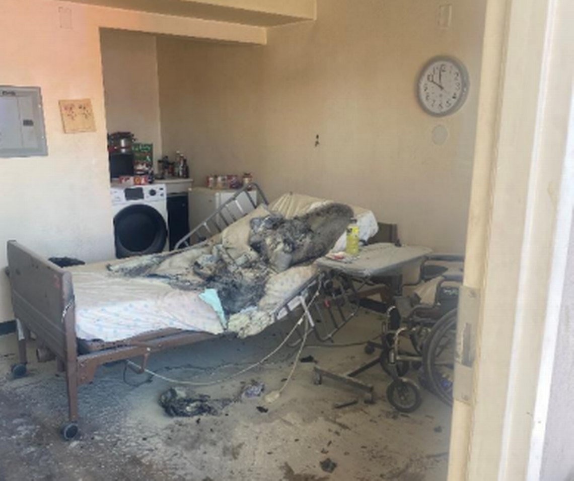 ‘Flash fire’ caused by oxygen tank nearly kills 73-year-old woman in Modesto