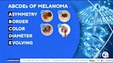 Signs to look out for with melanoma during Skin Cancer Awareness Month