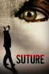 Suture