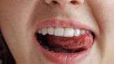 Do You Have A 'Scalloped Tongue'? Here's What It Says About Your Health.