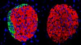 Pancreatic Beta Cells Function Without the Need of Other Endocrine Hormones