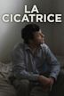 La Cicatrice