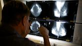 What is the recommended age for a mammogram? Panel issues new guidelines