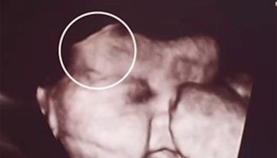 ¡Viral! El bebé con melena impresionante, que ya se veía en las ecografías. ¡Mira las fotos!