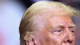 Campaña de Trump difunde informe sobre su herida: 'De 2 cm y sin suturas"