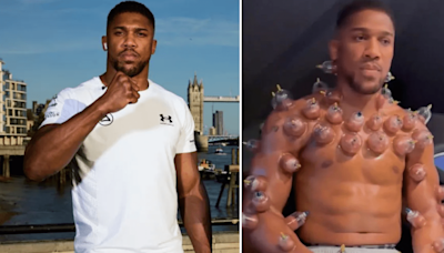 Anthony Joshua explains viral cupping therapy video that left fans baffled