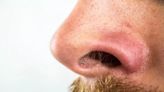 「鬼剃頭」恐影響鼻毛數量！研究證實：鼻毛越少越容易過敏