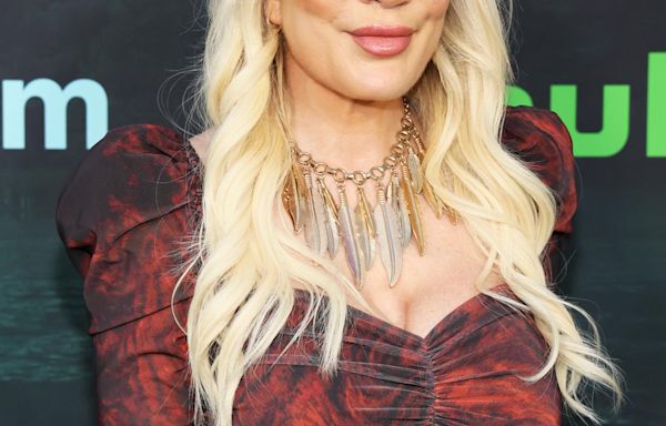 Tori Spelling Shares Why She Got Veneers: ‘My Smile Used to Be My Thing When I Was Young’