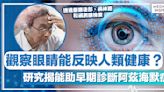 阿茲海默症 │ 觀察眼睛能反映人類健康？研究揭能助早期診斷阿茲海默症！