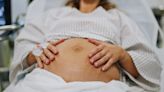 The 3 fatal conditions fuelling highest maternity deaths in 20 years revealed