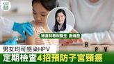 HPV｜HPV男女均可感染 定期檢查4招預防子宮頸癌