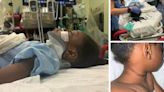 5-year-old Atlanta girl in ICU after freak summer camp accident involving slide, jump rope